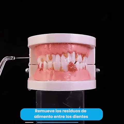 2X1: Irrigador Oral  Profesional Recargable + Kit de boquillas GRATIS